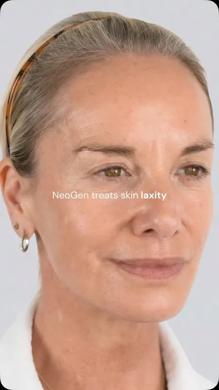 A woman's face against a pale background, with the words “NeoGen treats skin laxity” set across the frame