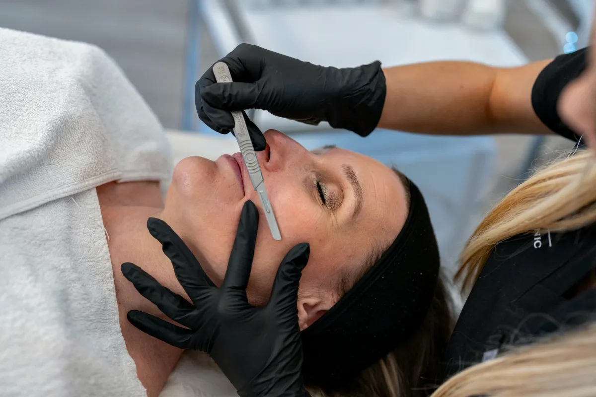 Dermaplaning at The London Road Clinic