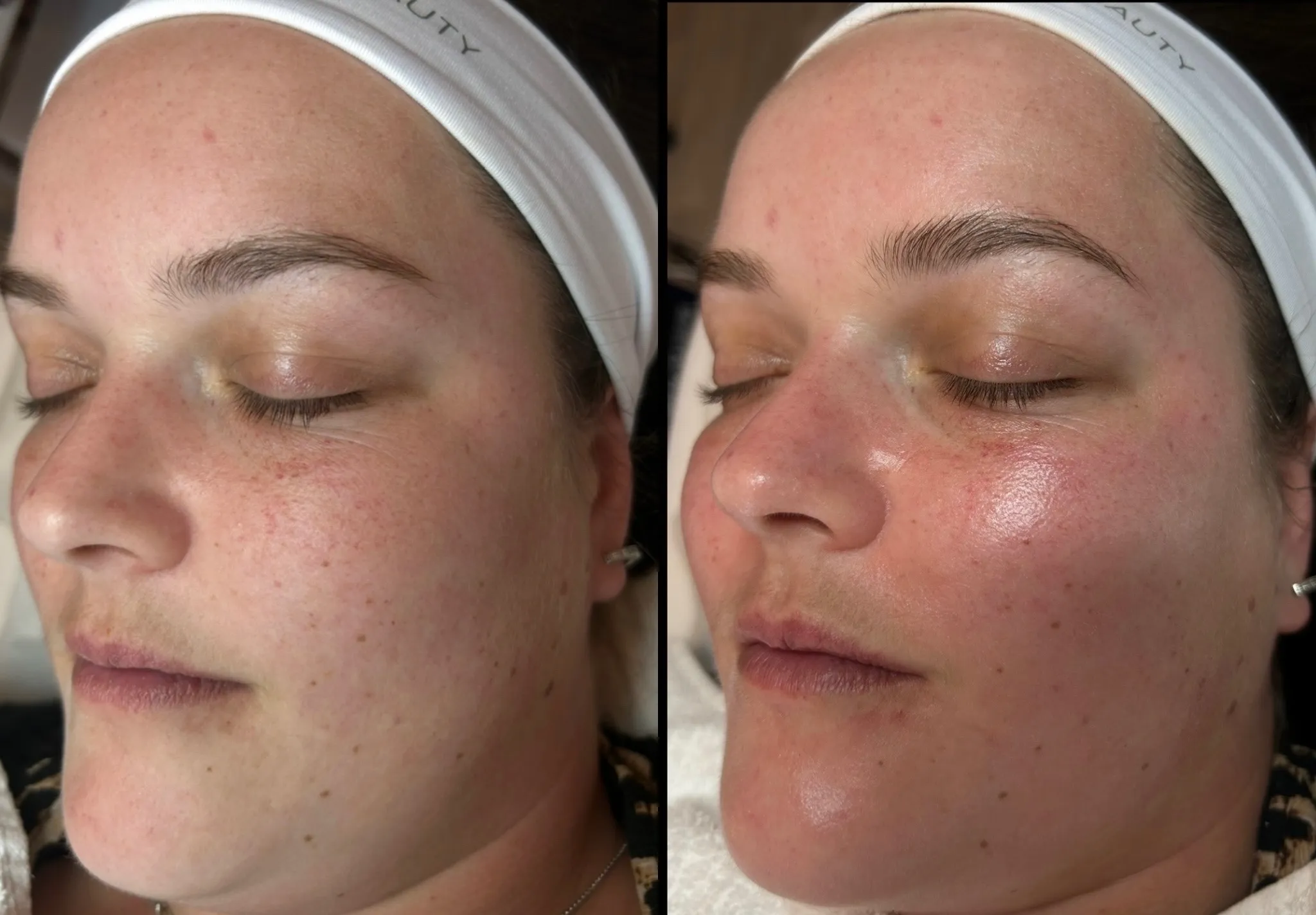 Hydra-Light at The London Road Clinic, Newark