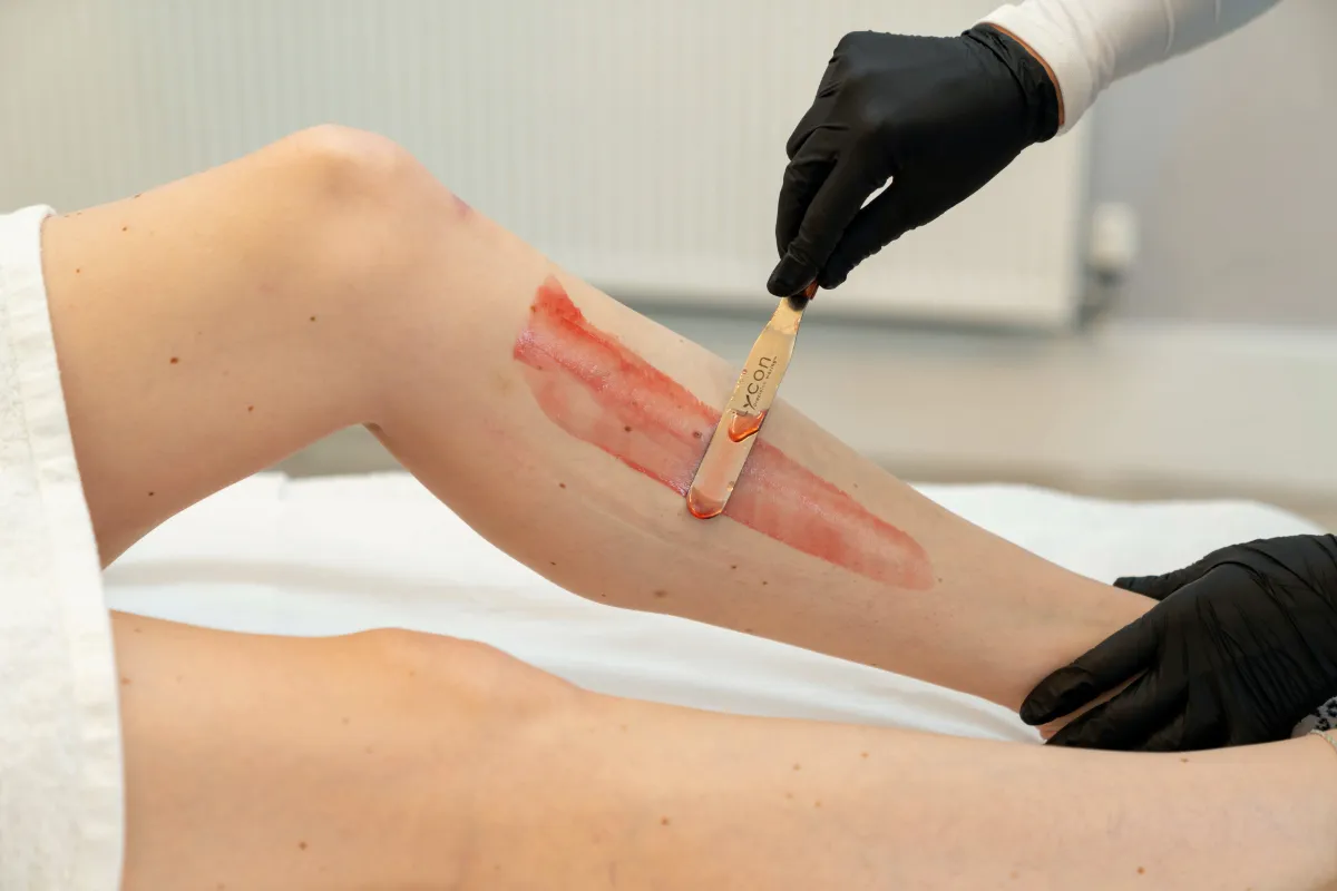 LYCON Waxing at The London Road Clinic