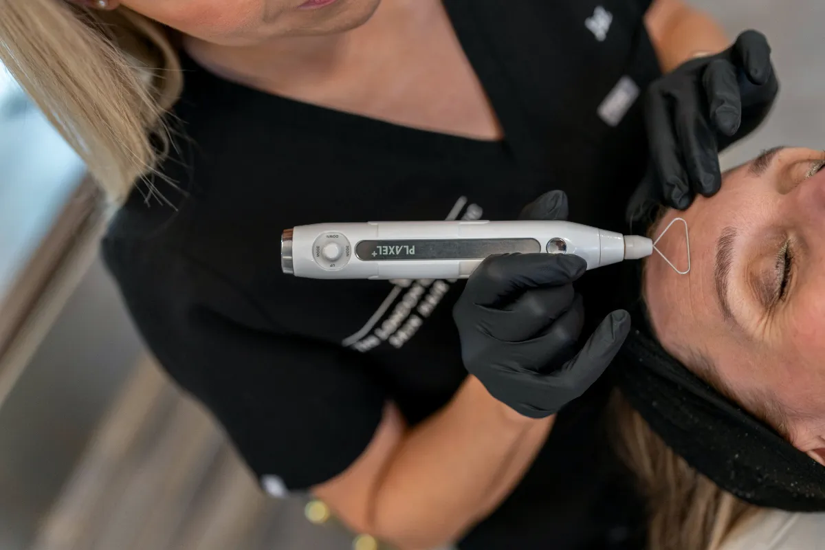 Plasma Pen (Plaxel+) at The London Road Clinic, Newark