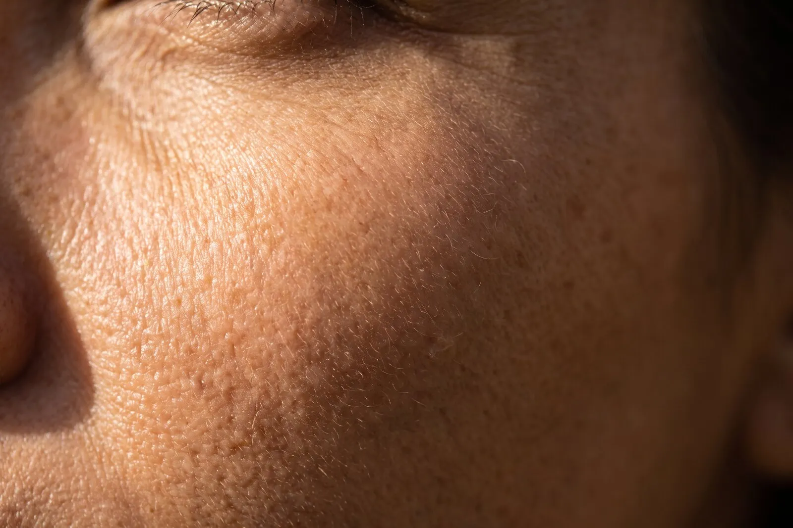 Macro photograph of skin at pore level, fine surface texture and open pores visible across the cheek.