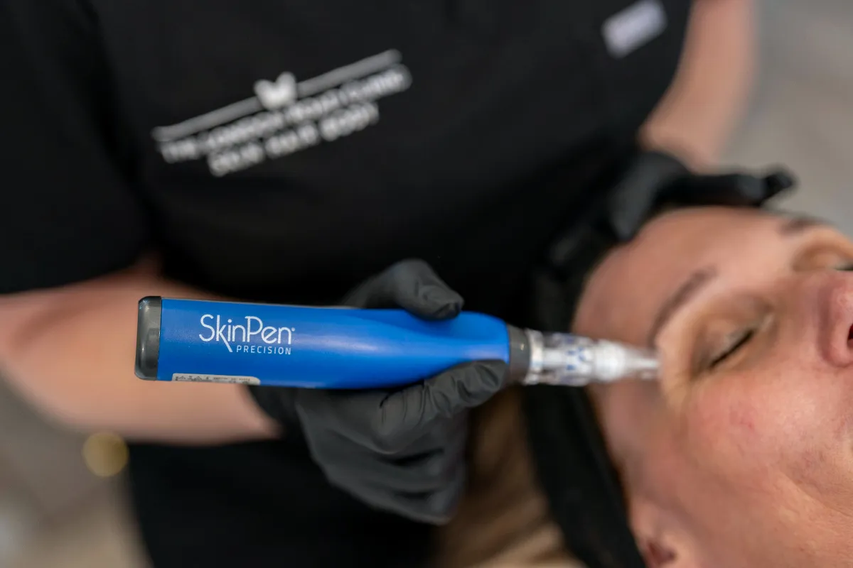 SkinPen Microneedling at The London Road Clinic